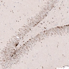 Immunohistochemical staining of rat dentate gyrus shows strong nuclear positivity in a subset of cells in granular layer.