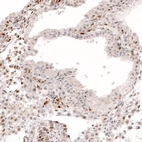 Immunohistochemical staining of human endometrium shows moderate to strong nuclear positivity in stromal cells.