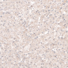 Immunohistochemical staining of human liver shows no nuclear positivity in hepatocytes as expected.