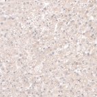 Anti-SOX4 Antibody