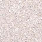 Immunohistochemical staining of human liver shows no nuclear positivity in hepatocytes as expected.