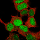 Anti-SOX4 Antibody