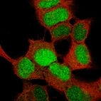 Immunofluorescence staining of SH-SY5Y cells using the Anti-SOX4 monoclonal antibody, showing specific staining in the nucleoplasm in green. Microtubule- and nuclear probes are visualized in red and blue, respectively (where available).
