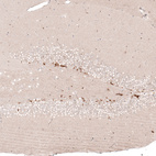 Immunohistochemical staining of mouse dentate gyrus shows strong nuclear positivity in a subset of neuronal cells.