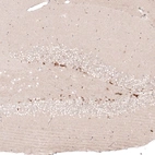 Immunohistochemical staining of mouse dentate gyrus shows strong nuclear positivity in a subset of neuronal cells.
