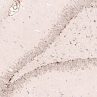 Immunohistochemical staining of rat brain shows strong nuclear positivity in a subset of neuronal cells in dentate gyrus.