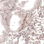 Immunohistochemical staining of human endometrium shows moderate to strong nuclear positivity in stromal cells.