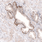 Anti-SOX4 Antibody