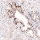 Immunohistochemical staining of human prostate shows moderate to strong nuclear positivity in a subset of glandular cells.