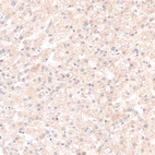 Immunohistochemical staining of human liver shows no nuclear positivity in hepatocytes as expected.