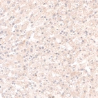 Immunohistochemical staining of human liver shows no nuclear positivity in hepatocytes as expected.