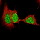 Immunofluorescence staining of SH-SY5Y cells using the Anti-SOX4 monoclonal antibody, showing specific staining in the nucleoplasm in green. Microtubule- and nuclear probes are visualized in red and blue, respectively (where available).