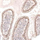 Immunohistochemical staining of human small intestine shows moderate nuclear positivity in glandular cells.