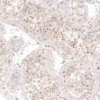 Immunohistochemical staining of human testis shows weak to moderate nuclear positivity in a subset of cells in seminiferous ducts.