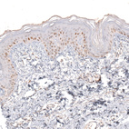 Immunohistochemical staining of human skin shows moderate nuclear positivity in squamous epithelial cells.