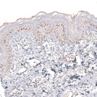 Anti-SOX6 Antibody