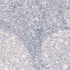 Immunohistochemical staining of human tonsil shows no positivity in non-germinal center cells as expected.