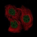 Immunofluorescence staining of CACO-2 cells using the Anti-SOX6 monoclonal antibody, showing specific staining in the nucleoplasm in green. Microtubule- and nuclear probes are visualized in red and blue, respectively (where available).