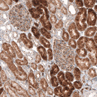 Immunohistochemical staining of human kidney shows cytoplasmic immunoreactivity in both renal glomeruli and tubules.
