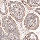 Immunohistochemical staining of human small intestine shows moderate granular cytoplasmic positivity in glandular cells.