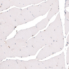 Immunohistochemical staining of human skeletal muscle shows absence of positivity in striated muscle fibers as expected (negative control).