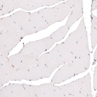 Immunohistochemical staining of human skeletal muscle shows absence of positivity in striated muscle fibers as expected (negative control).