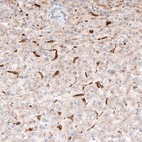 Immunohistochemical staining of human liver shows cytoplasmic immunoreactivity in Kupffer cells.