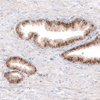 Immunohistochemical staining of human prostate shows moderate granular cytoplasmic immunoreactivity in glandular cells.