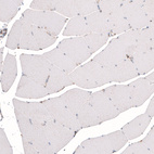 Immunohistochemical staining of human skeletal muscle shows absence of positivity in striated muscle fibers as expected (negative control).