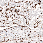 Immunohistochemical staining of human placenta shows nuclear positivity in the trophoblast.