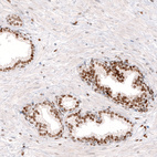 Immunohistochemical staining of human prostate shows nuclear immunoreactivity in glandular cells.