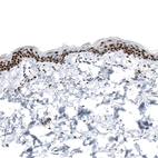 Immunohistochemical staining of human skin shows strong nuclear positivity in epithelial cells.
