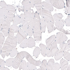 Immunohistochemical staining of human skeletal muscle shows absence of positivity in striated muscle fibers as expected (negative control).