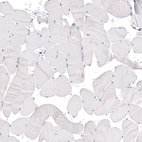 Immunohistochemical staining of human skeletal muscle shows absence of positivity in striated muscle fibers as expected (negative control).