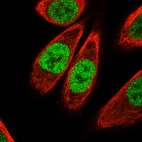 Immunofluorescence staining of PC-3 cells using the Anti-KLF4 monoclonal antibody, showing specific staining in the nucleoplasm in green. Microtubule- and nuclear probes are visualized in red and blue, respectively (where available).