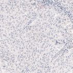 Anti-NANOG Antibody