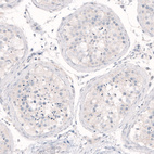Immunohistochemical staining of human testis shows absence of positivity as expected (negative control).