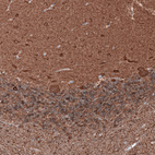 Immunohistochemical staining of human cerebellum shows strong positivity in both neurons and neuropil.