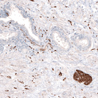 Immunohistochemical staining of human prostate shows strong positivity in the peripheral nerves.