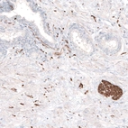 Immunohistochemical staining of human prostate shows strong positivity in peripheral nerves.
