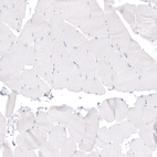 Immunohistochemical staining of human skeletal muscle shows no positivity in myocytes as expected.