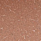Immunohistochemical staining of rat cerebral cortex shows strong positivity in neuronal cell bodies and in neuropil.