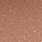 Anti-TUBB3 Antibody