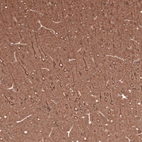 Immunohistochemical staining of rat brain shows strong cytoplasmic positivity in neurons.