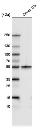 Western blot analysis in human cerebral cortex tissue.