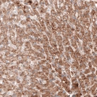 Anti-G6PC Antibody