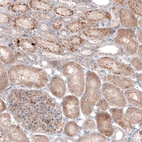 Immunohistochemical staining of human kidney shows moderate cytoplasmic immunoreactivity in renal tubules and in glomerulus.