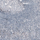 Immunohistochemical staining of human tonsil shows absence of positivity in lymphoid cells as expected (negative control).