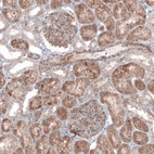Immunohistochemical staining of human kidney shows moderate cytoplasmic positivity in cells in glomeruli.