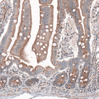 Anti-G6PC Antibody